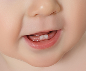 olakšavanje nicanja mlečnih zuba-ApotekaPLUS